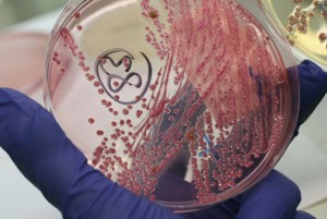 Bactéria não teria começado em fazenda bacteria