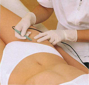 Depilação íntima (O que dizem os profissionais médicos sobre os perigos de ficar sem pelos na região genital) depilaao-intima