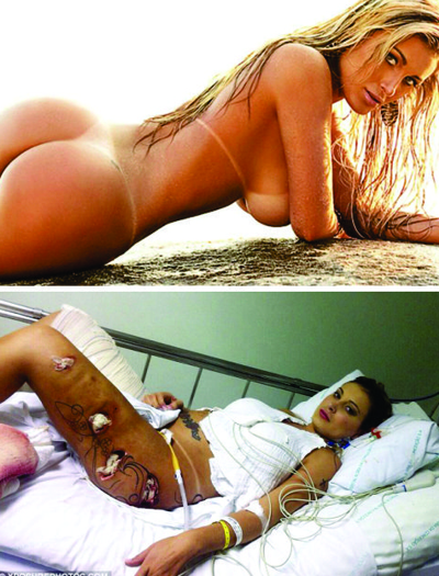 urach