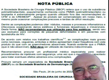 SBCP em Nota Pública faz alerta sobre uso criminoso do PMMA - Polimetilmetacrilato, utilizado em bioplastia (veja vídeo) PMMA 2