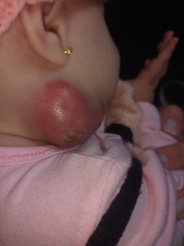 SAÚDE DE DIVINOPOLIS NO CTI: bebê de 7 meses sofre para ser atendida na UPA Padre Roberto; mãe desmaia (vídeo) bebe