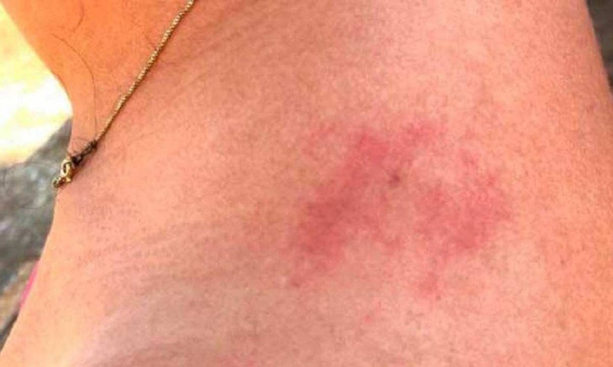 Homem agride esposa alegando que ela utiliza “roupa incompatível com mulher casada”