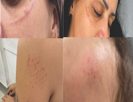 Mãe é agredida na UPA Divinópolis por adolescente com transtorno do espectro autista (TEA); CIS-URG OESTE, lamenta incidente impreevisível agressão upa 3