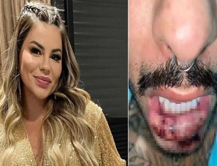 Biomédica Lorena Marcondes é condenada a quatro anos de prisão, por lesão corporal e exercício ilegal da medicina; e pagar R$ 50 mil de indenização Lorena e modelo 2