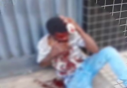 Homem leva machadada na cabeça e fica com o corpo ensanguentado no Niterói homem f3rido av governador magalhães pinto niteroi divinópolis capa site
