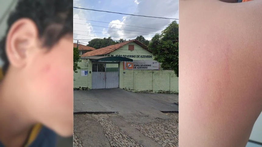 Mãe denuncia omissão e diz que escola normalizou agressão contra aluno em Divinópolis; instituição nega o fato
