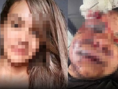 Mulher fica com o rosto desfigurado após ser brutalmente agredida por ex-atleta Imagem do WhatsApp de 2025-07-29 à(s) 13.44.06_c17e49ff