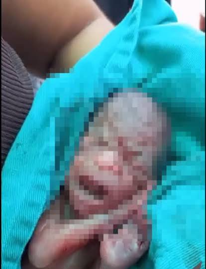 Milagre ou erro médico? Bebê dado como morto chora dentro do caixão durante velório no Acre; é socorrido, mas morre no dia seguinte