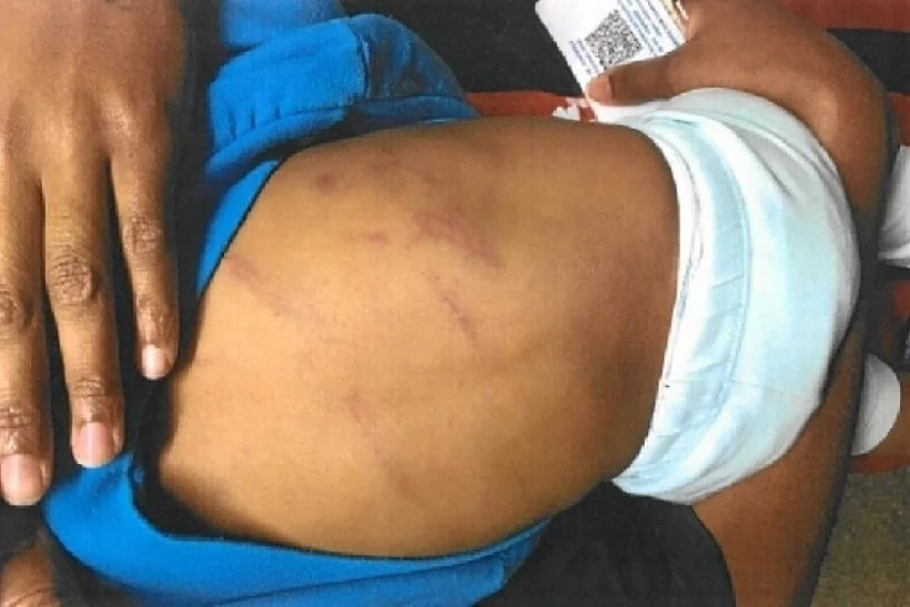 Mãe e padrasto são presos após torturarem bebê de 1 ano com chutes e mordidas em Dourados