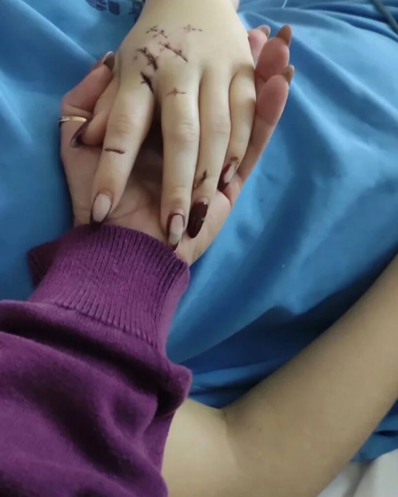 Jovem esfaqueada mais de 15 vezes deixa coma e já respira sem aparelhos Jaderluce Anísio de Oliveira, mãe de Alana Anísio Rosa, de 20 anos, informou, nesse sábado (21-2
