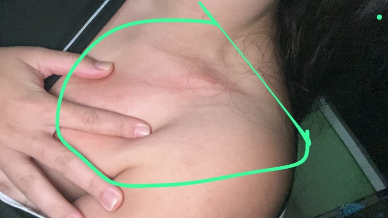 “Lázaro de Ermida”: jovem foi atacada em ponto de ônibus no dia do aniversário