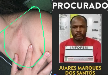 Mulher relata como foi ataque em ponto de ônibus na zona rural de Divinópolis ; “Lázaro de Ermida” é suspeito
