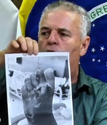 Vereador Hilton de Aguiar cobra de Cleitinho melhorias na regulação da saúde em Minas